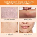 Mintox Orange Exfoliating Whitening Gel - Image 3