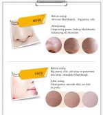 Bioaqua Activated Blackhead Removal - Image 4